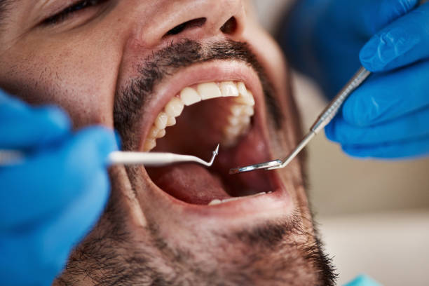 Best Dental Fillings (Composite and Amalgam)  in Pinehurst, TX